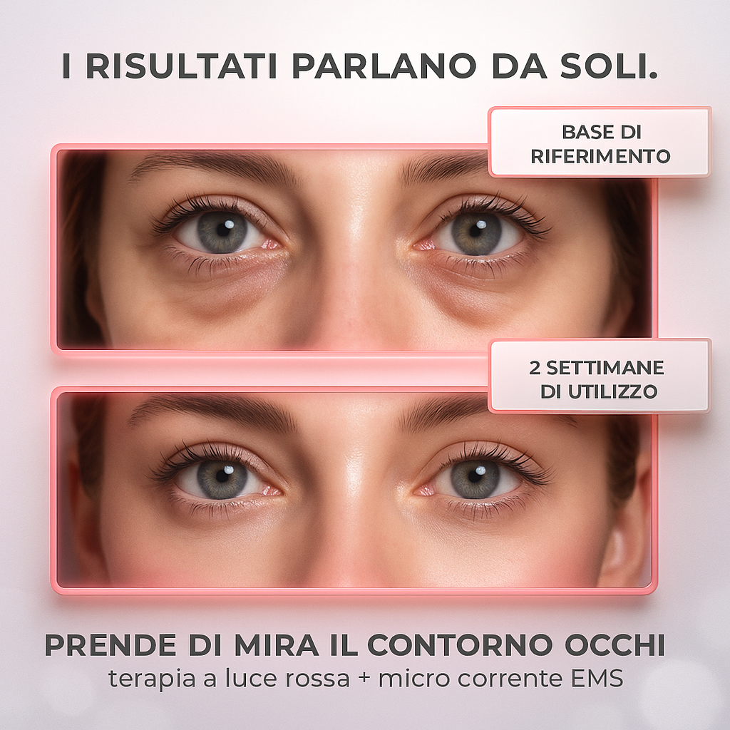 Jova™ - Dispositivo terapia a luce rossa